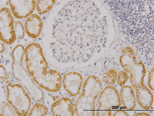 RASGRP4 Antibody in Immunohistochemistry (Paraffin) (IHC (P))