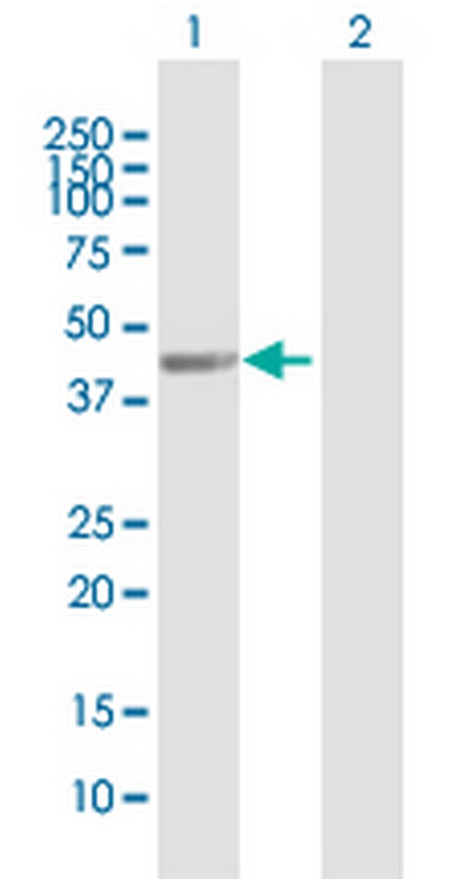 WDFY2 Antibody in Western Blot (WB)