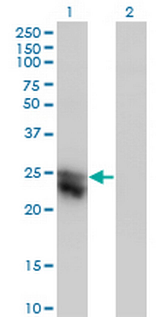 CTHRC1 Antibody in Western Blot (WB)