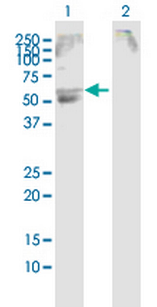 SLC22A12 Antibody in Western Blot (WB)