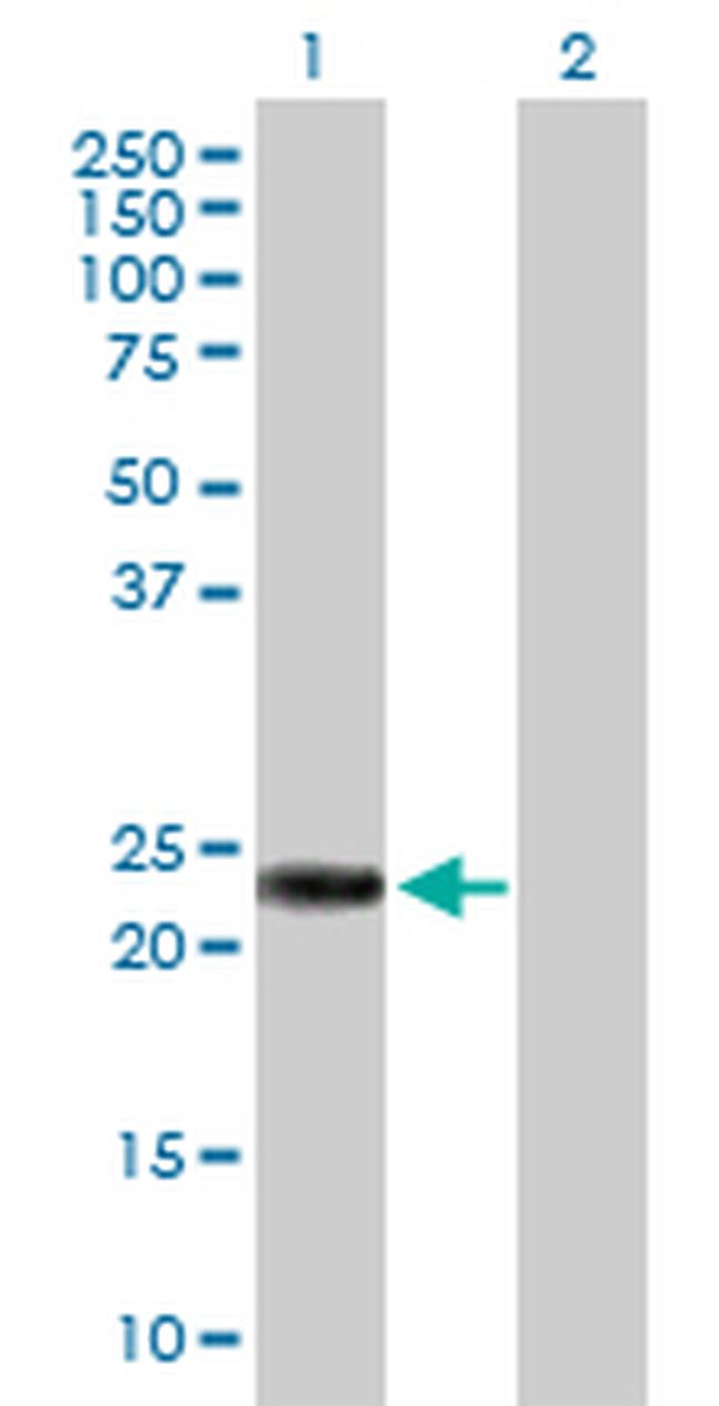 RAB39B Antibody in Western Blot (WB)