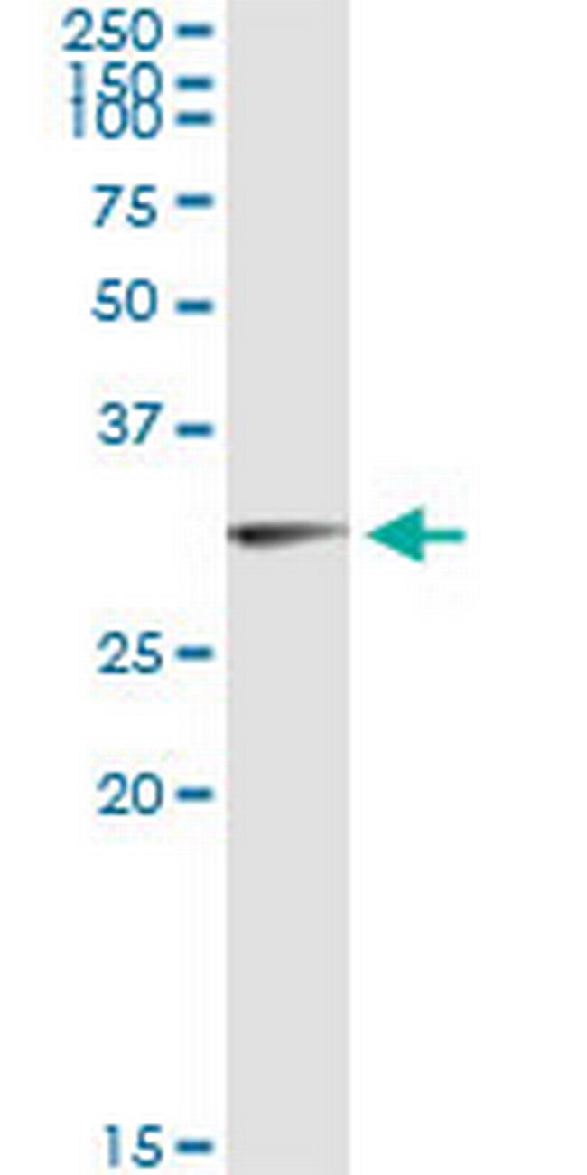 OLIG1 Antibody in Immunoprecipitation (IP)