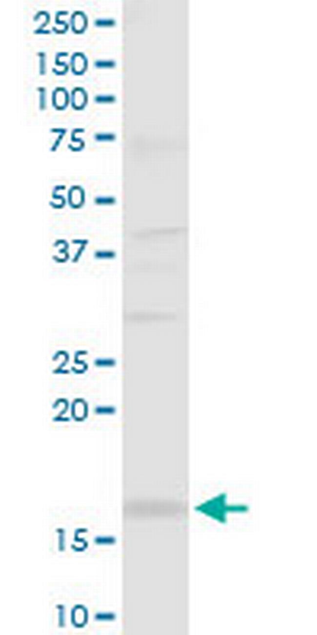 SH2D1B Antibody in Western Blot (WB)