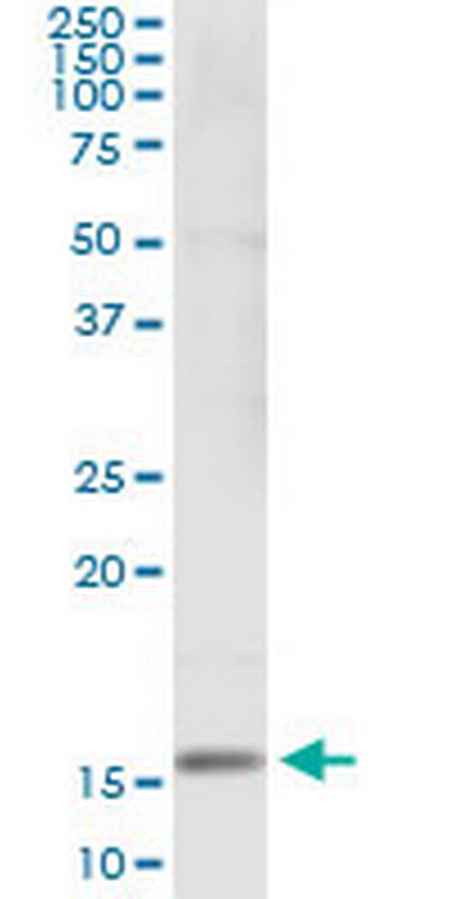 SH2D1B Antibody in Immunoprecipitation (IP)