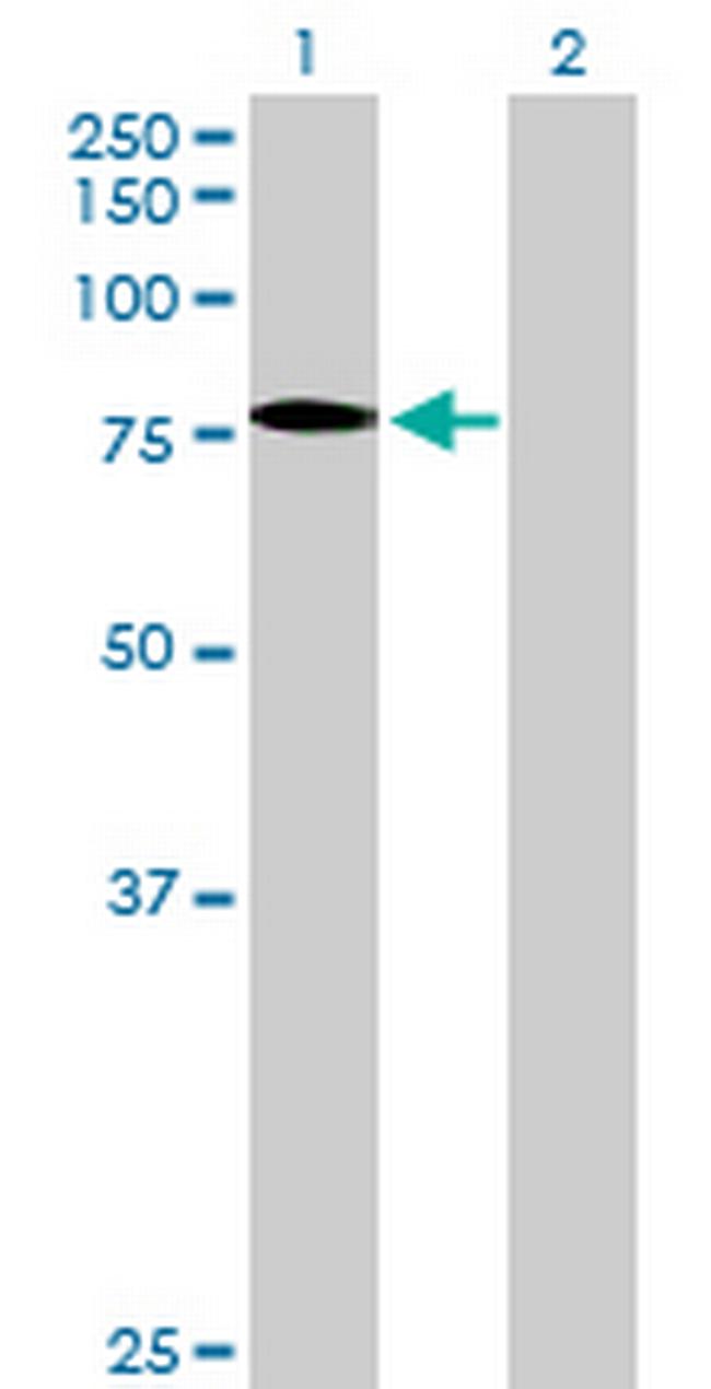 SSX2IP Antibody in Western Blot (WB)