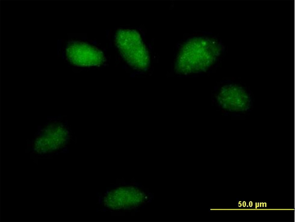 GSTO2 Antibody in Immunocytochemistry (ICC/IF)