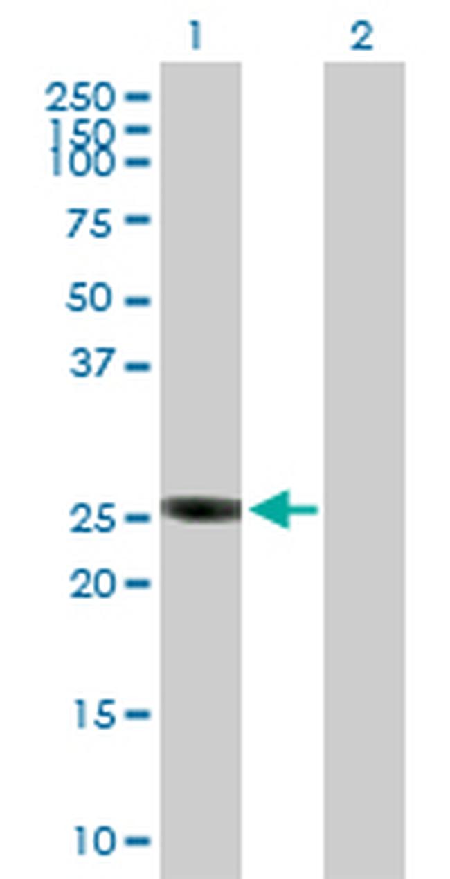 GSTO2 Antibody in Western Blot (WB)