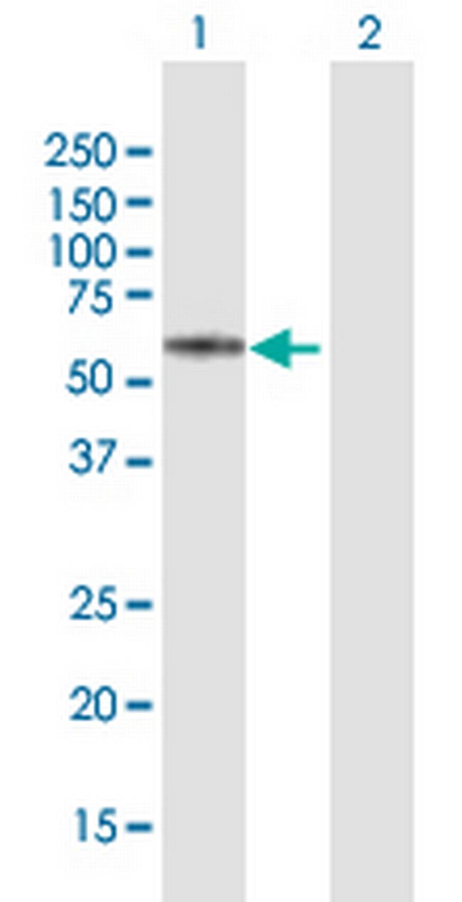 KRT74 Antibody in Western Blot (WB)