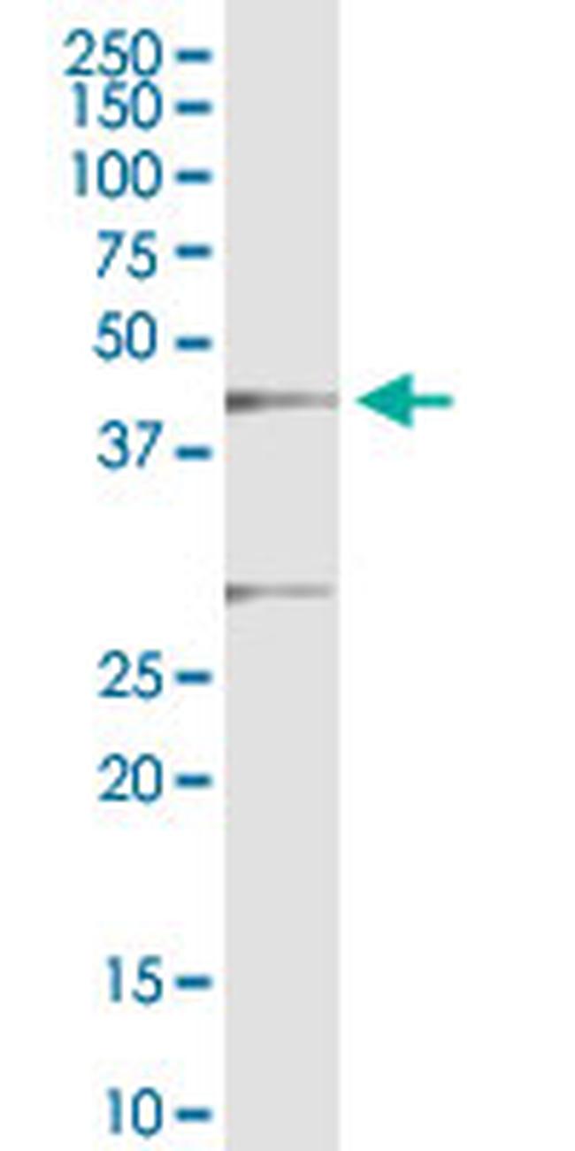 IKIP Antibody in Western Blot (WB)