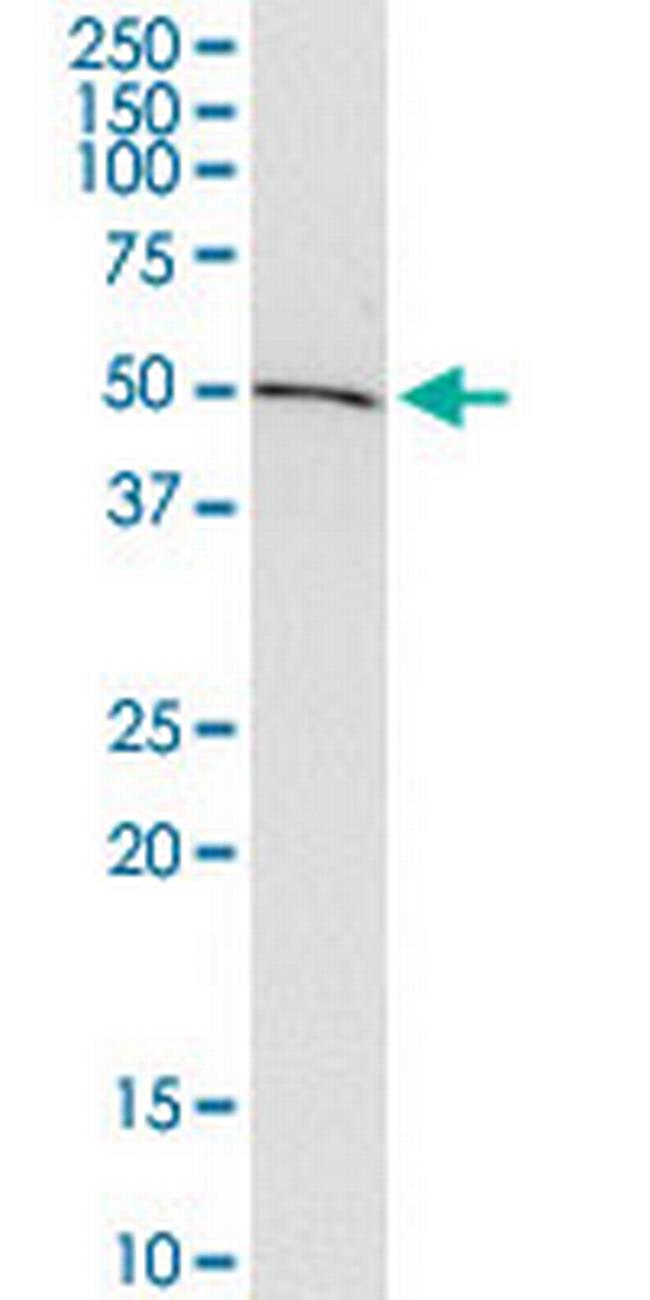 ADSSL1 Antibody in Western Blot (WB)