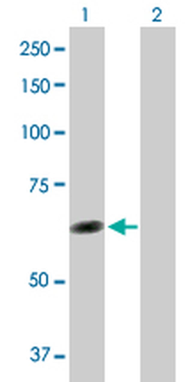 TTC8 Antibody in Western Blot (WB)