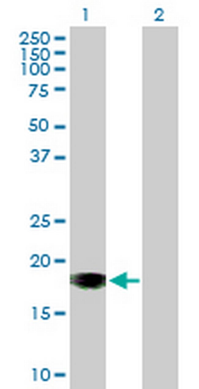 SLIC1 Antibody in Western Blot (WB)