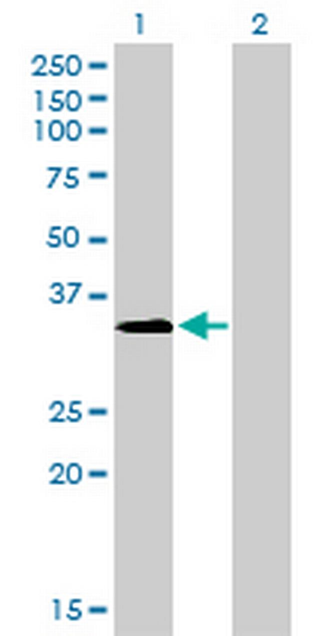 MSI2 Antibody in Western Blot (WB)