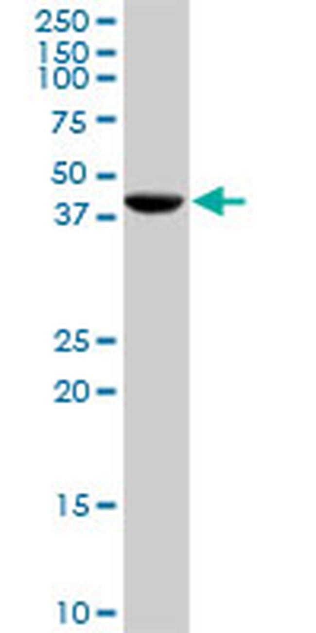 CANT1 Antibody in Western Blot (WB)