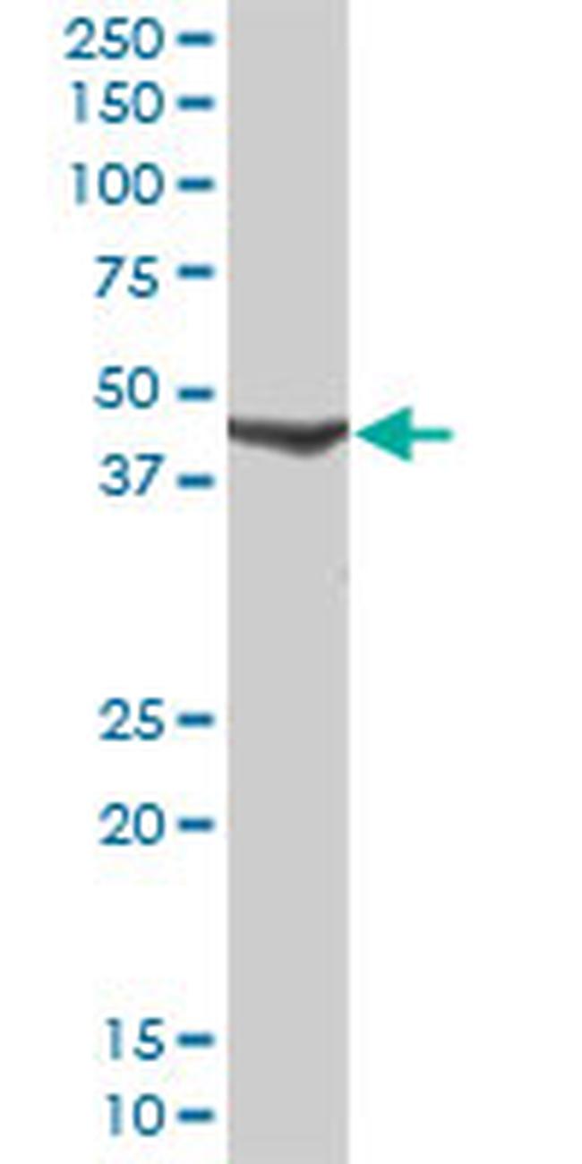 CANT1 Antibody in Western Blot (WB)