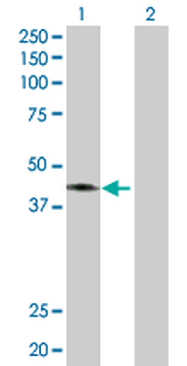 CANT1 Antibody in Western Blot (WB)