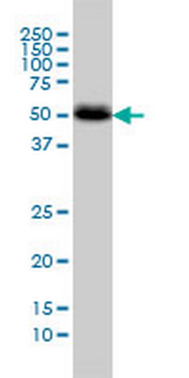 CANT1 Antibody in Western Blot (WB)