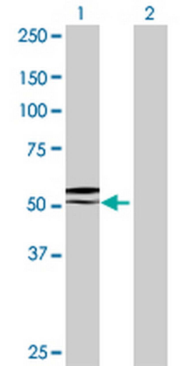 GGT6 Antibody in Western Blot (WB)