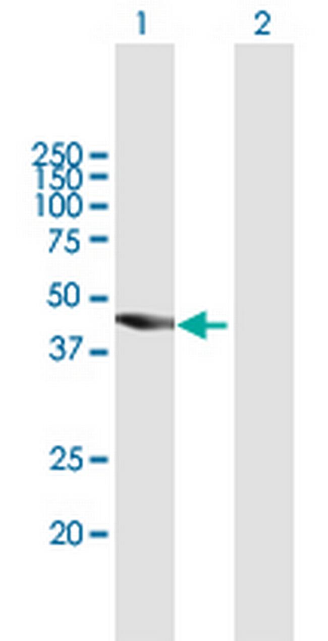 TBC1D16 Antibody in Western Blot (WB)