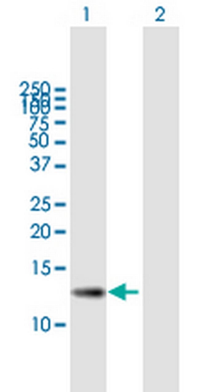 ZSWIM7 Antibody in Western Blot (WB)