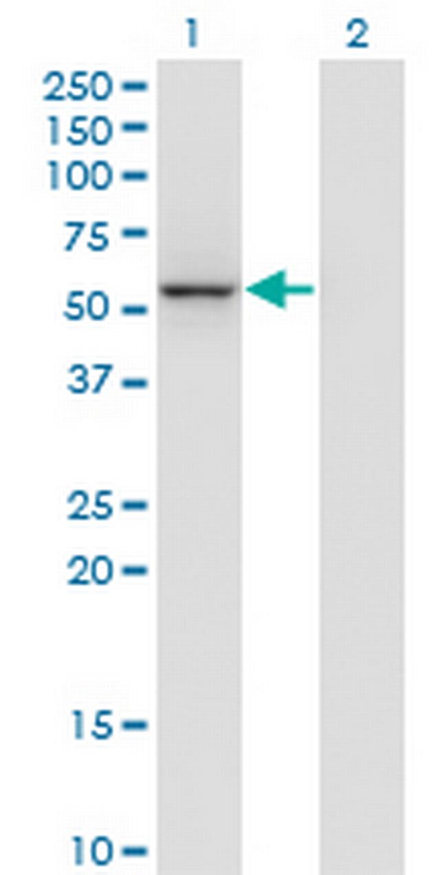 MGC29891 Antibody in Western Blot (WB)
