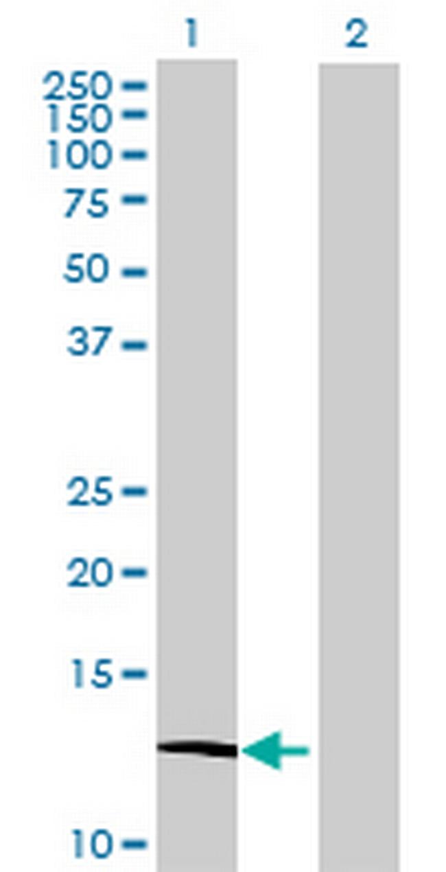 ATP6V1G3 Antibody in Western Blot (WB)