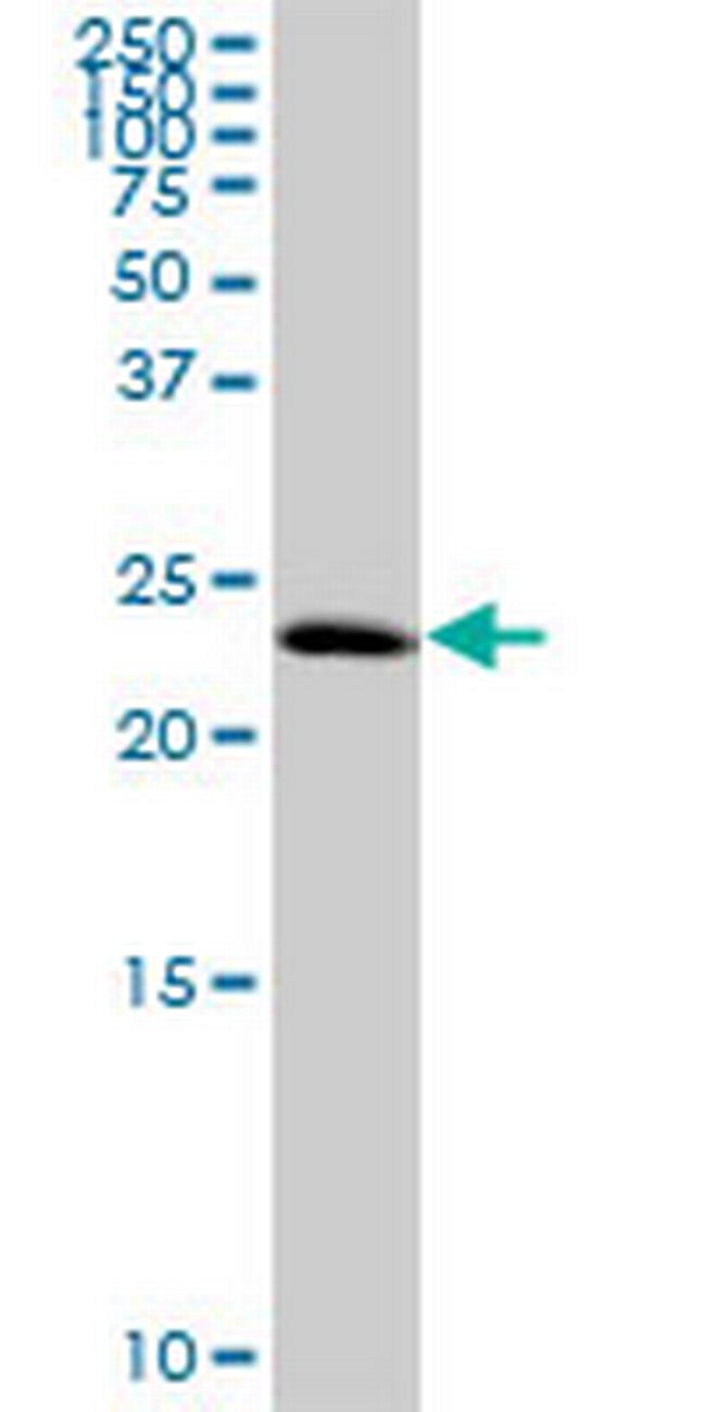 C1orf83 Antibody in Western Blot (WB)