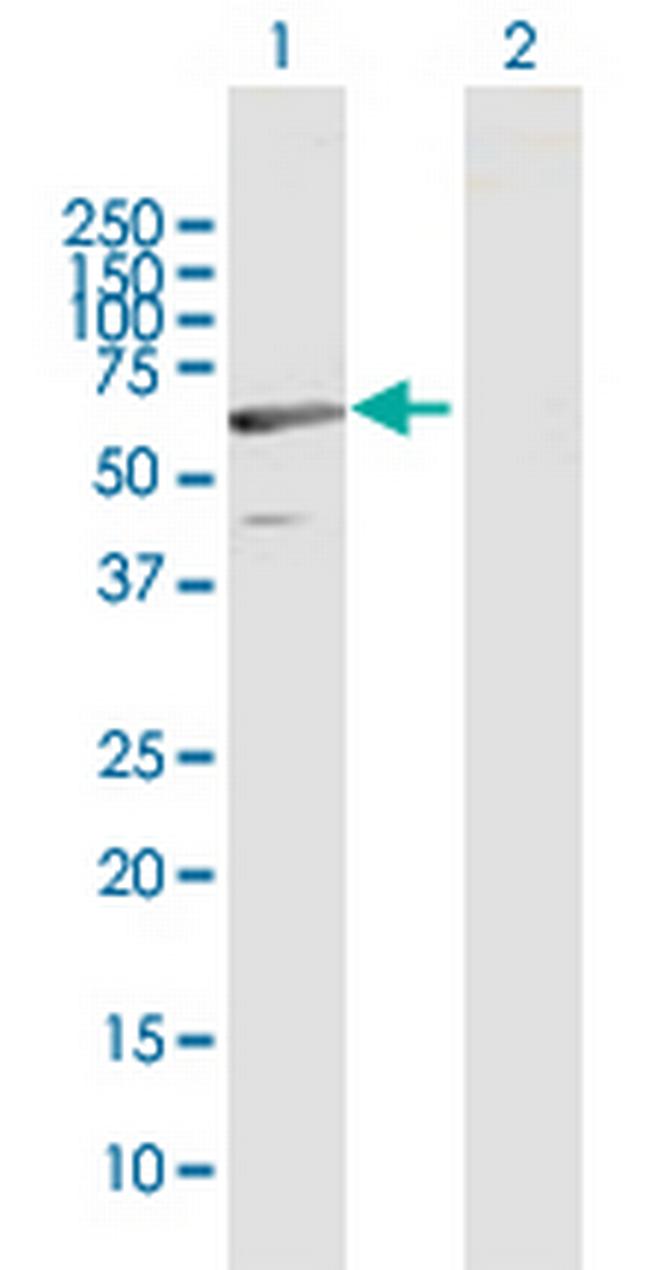 C1orf87 Antibody in Western Blot (WB)