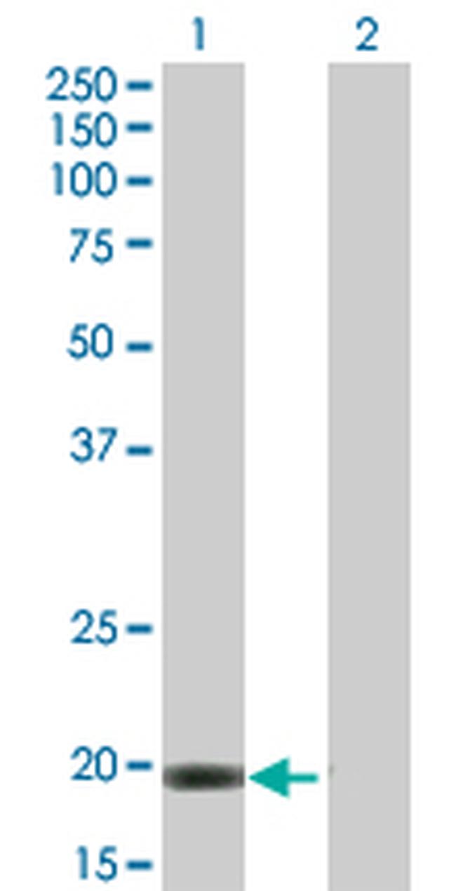 C20ORF102 Antibody in Western Blot (WB)