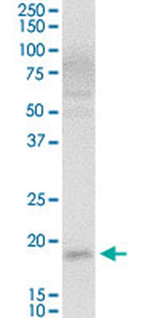 VSTM2L Antibody in Western Blot (WB)