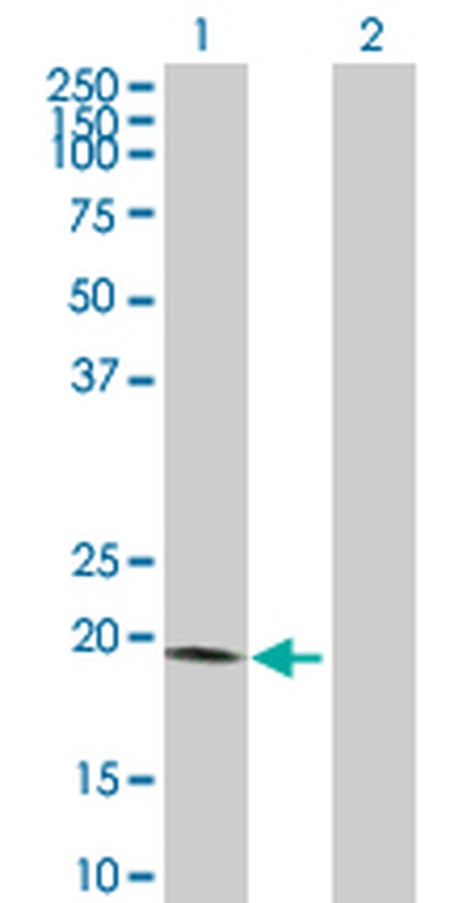 VSTM2L Antibody in Western Blot (WB)