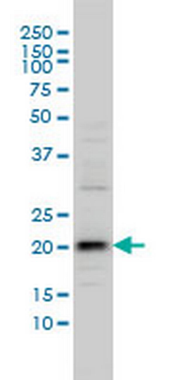 C20orf102 Antibody in Western Blot (WB)