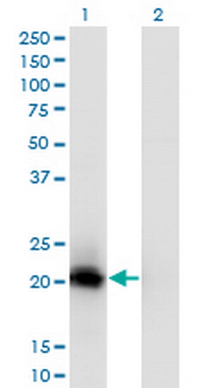 C20orf102 Antibody in Western Blot (WB)