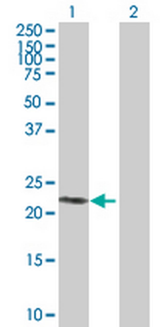 SIRPD Antibody in Western Blot (WB)