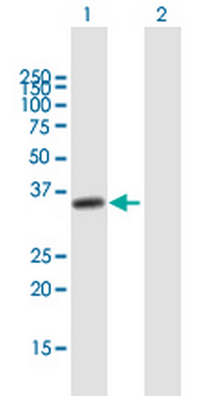 NUP35 Antibody in Western Blot (WB)