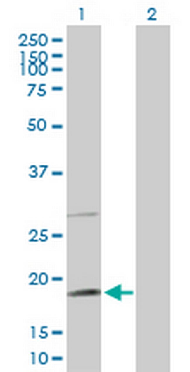 TAF8 Antibody in Western Blot (WB)