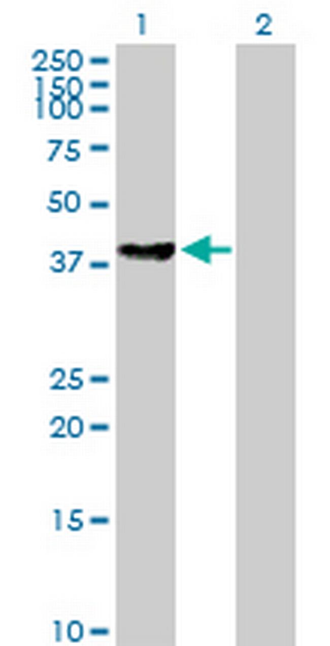 BBS5 Antibody in Western Blot (WB)