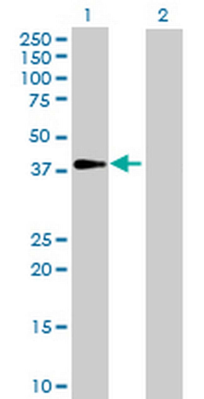 GALM Antibody in Western Blot (WB)