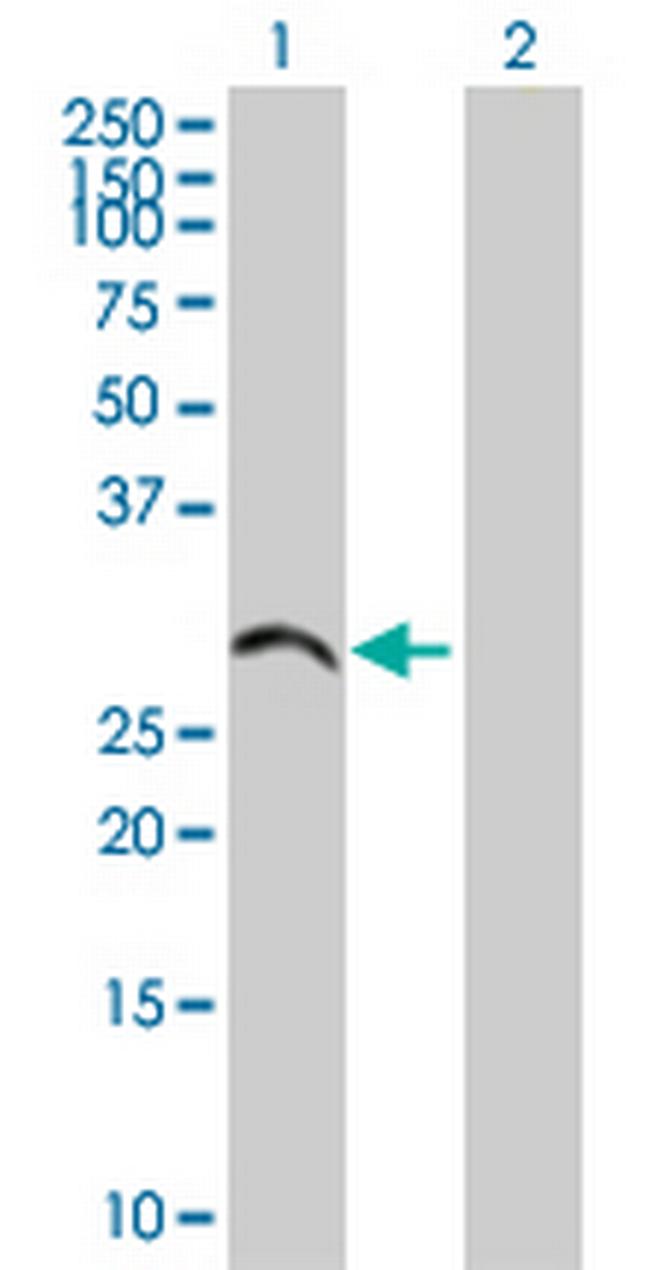 ZDHHC19 Antibody in Western Blot (WB)