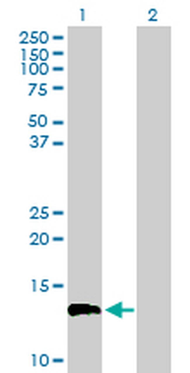 FLJ39155 Antibody in Western Blot (WB)