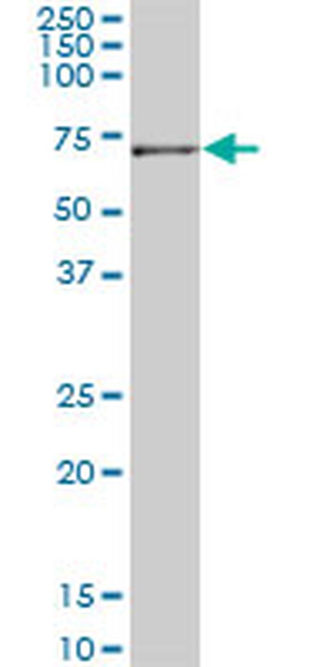 JMY Antibody in Western Blot (WB)