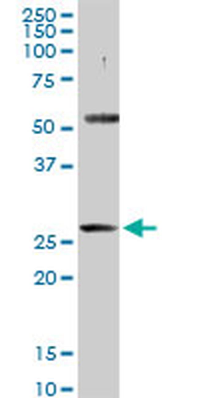 PACRG Antibody in Western Blot (WB)