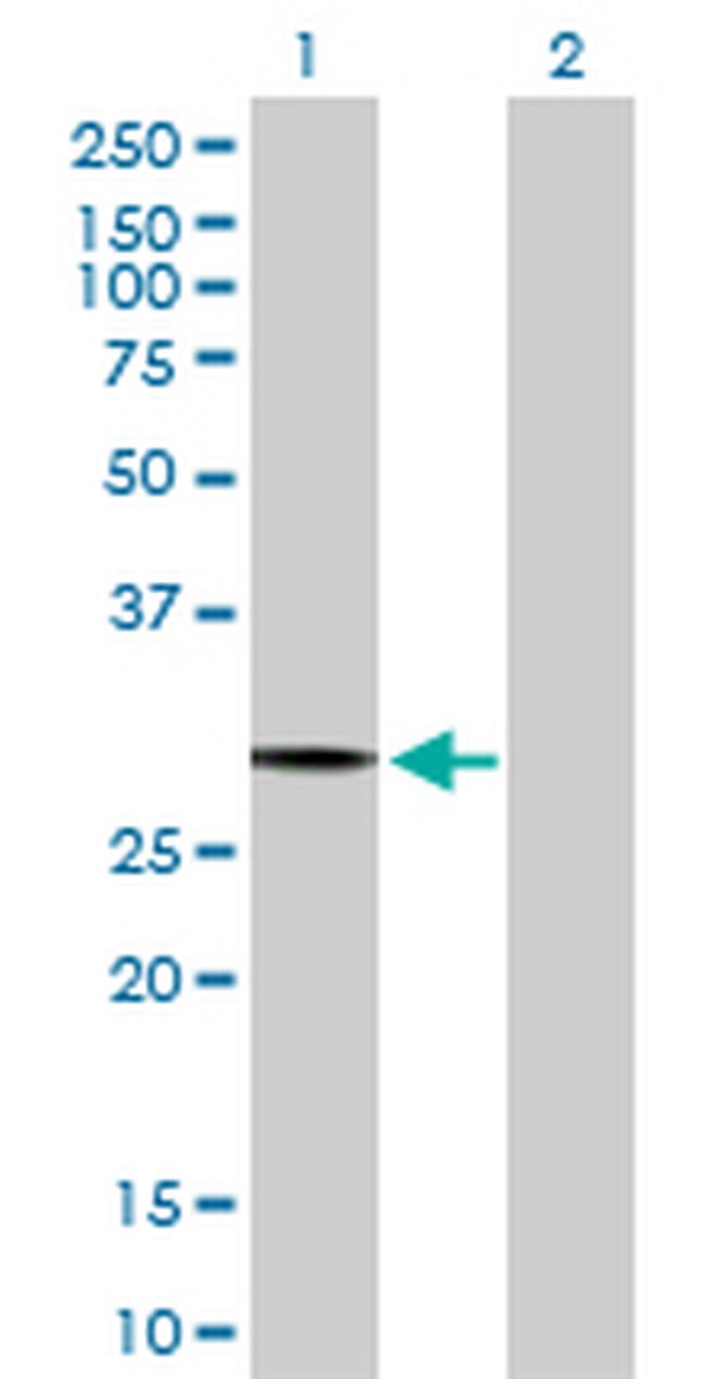 PACRG Antibody in Western Blot (WB)