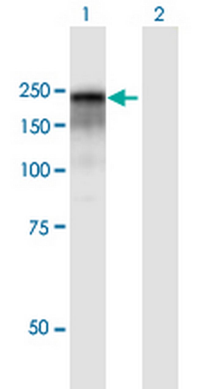 CD109 Antibody in Western Blot (WB)