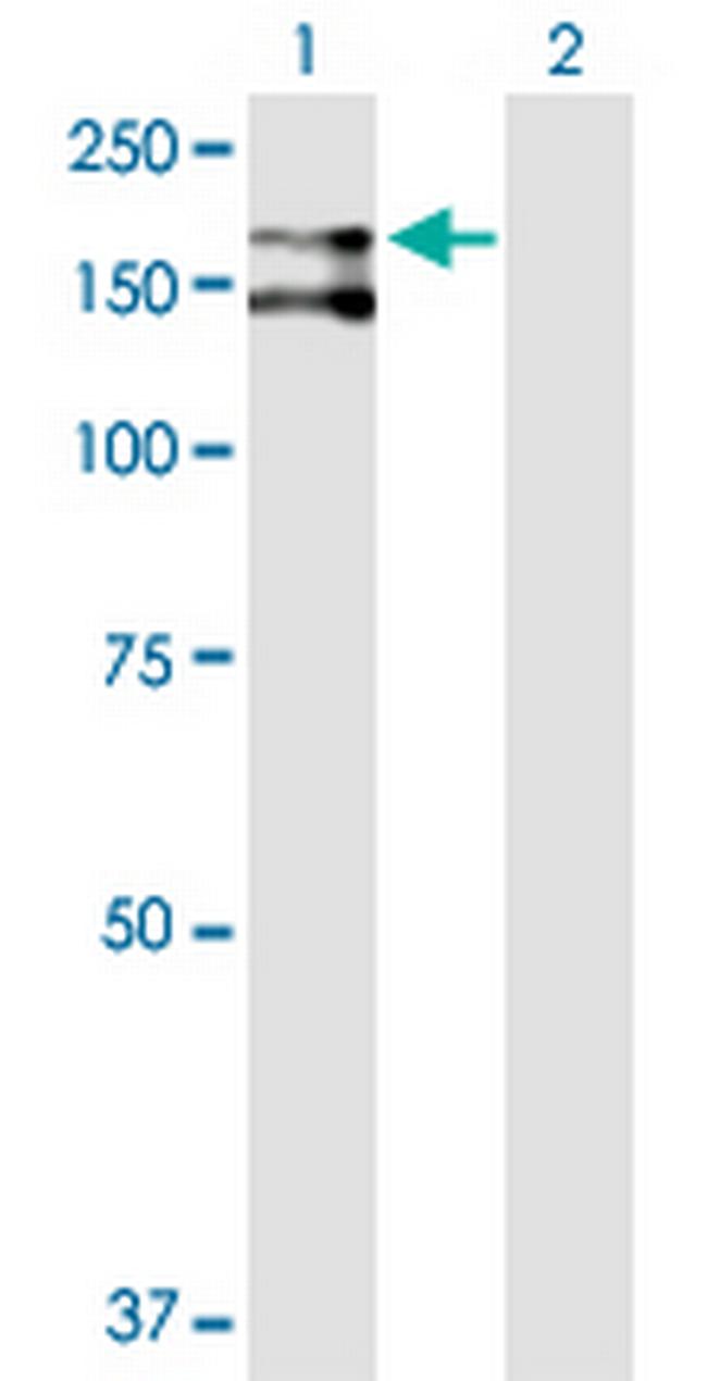 CD109 Antibody in Western Blot (WB)