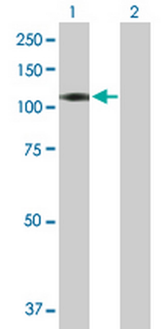 CXorf20 Antibody in Western Blot (WB)