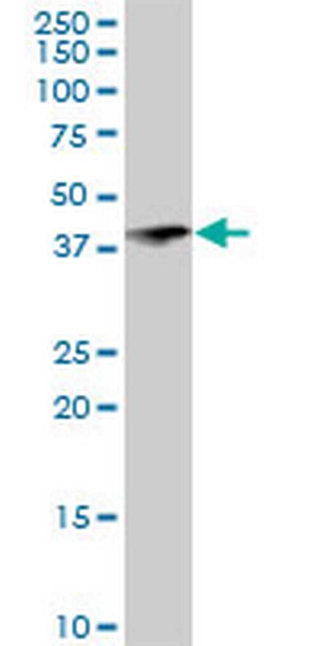 RNF113B Antibody in Western Blot (WB)