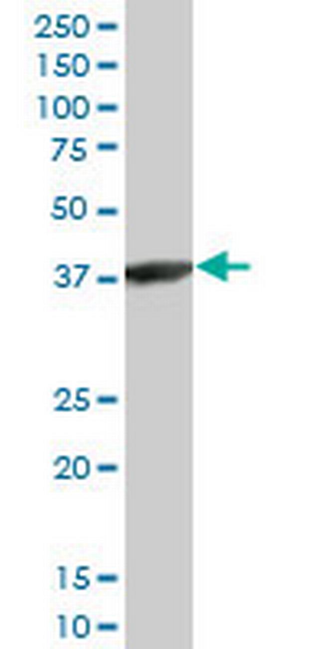 ACTRT2 Antibody in Western Blot (WB)