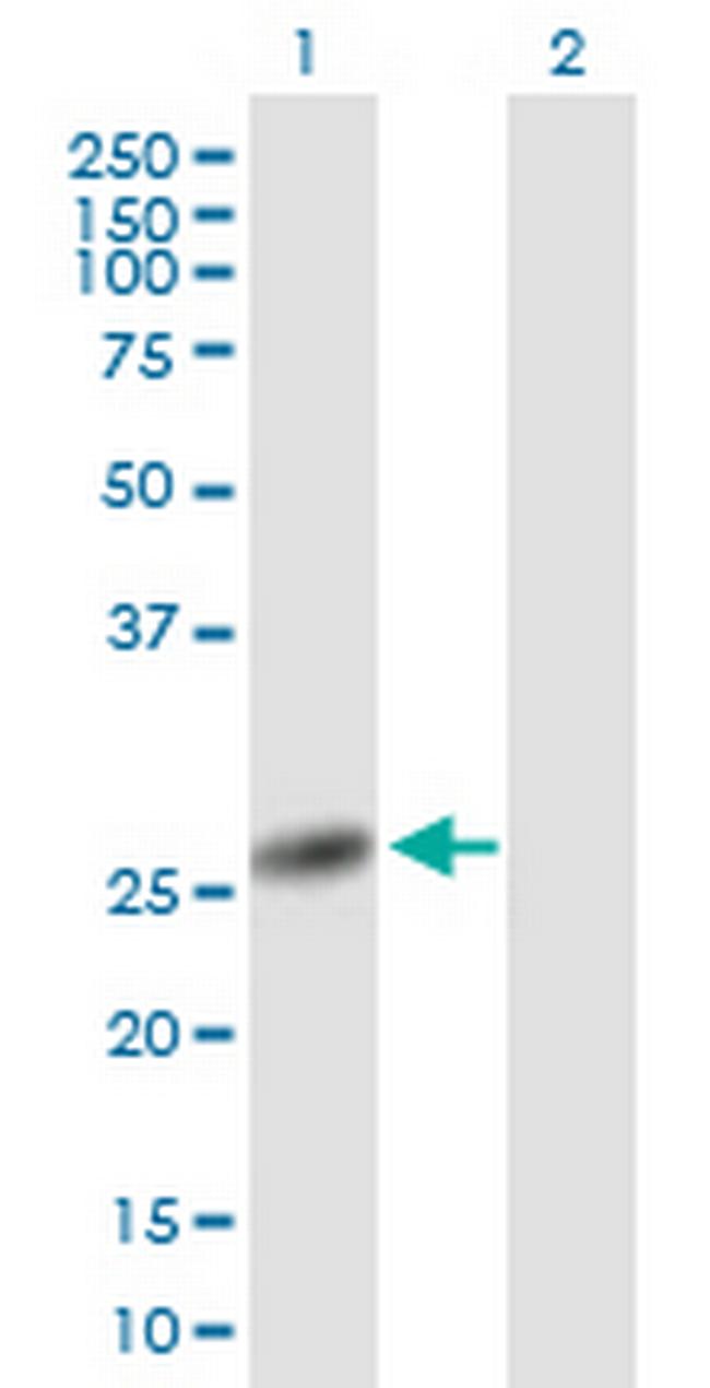 NANP Antibody in Western Blot (WB)