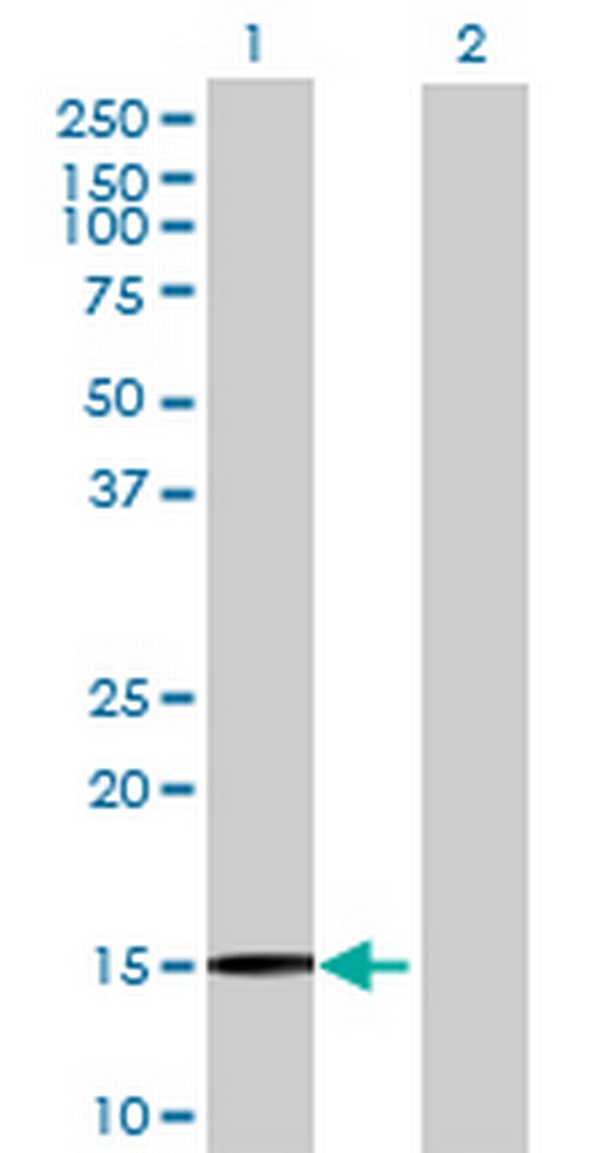 C20orf79 Antibody in Western Blot (WB)